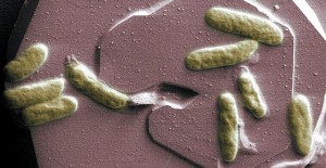 Image: Shewanella oneidensis bacteria, Alice Dohnalkova. (downloaded from http://www.uea.ac.uk/mac/comm/media/press/2013/March/bio-batteries)