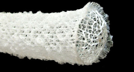 Downloaded from: http://io9.com/5085064/giant-deep-sea-sponges-evolved-fiber-optic-exoskeletons