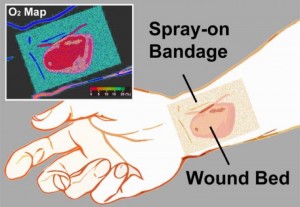 Caption: The transparent liquid bandage displays a quantitative, oxygenation-sensitive colormap that can be easily acquired using a simple camera or smartphone. Credit: Li/Wellman Center for Photomedicine.