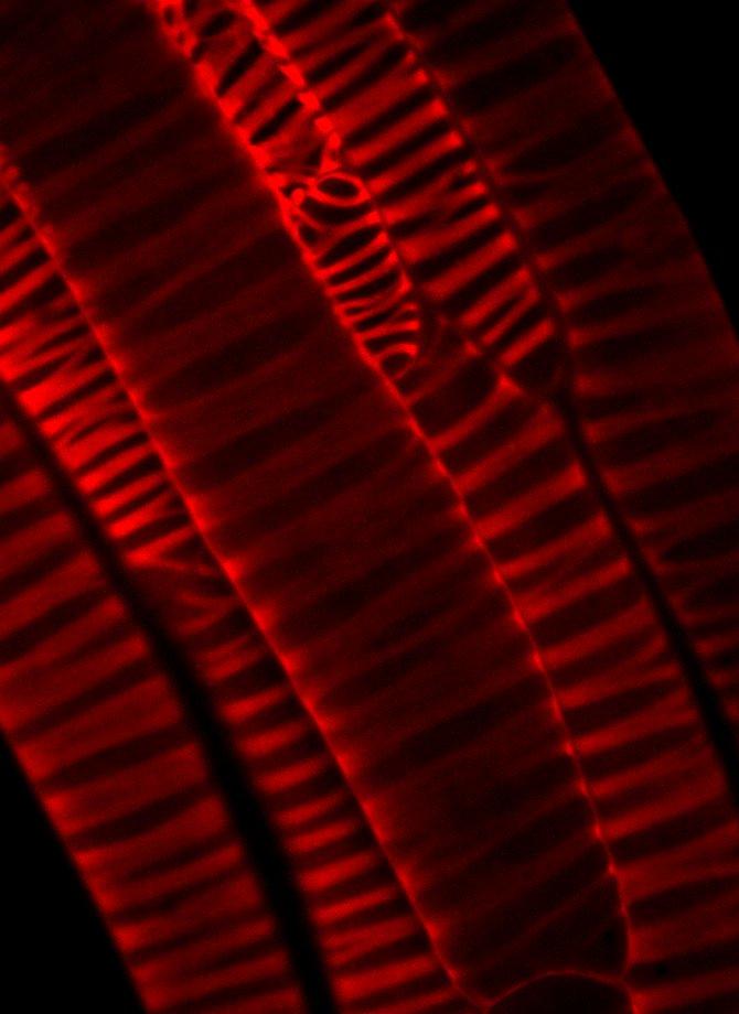  Caption: An image of artificially-produced cellulose in cells on the surface of a modified Arabidopsis thaliana plant. Credit: University of British Columbia.